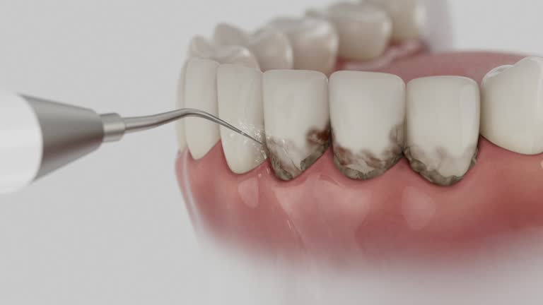 Reliable Dental Implants contractor in Riverdale, CA by Smile Center Dentistry